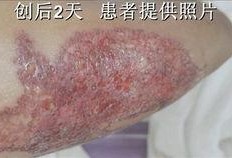 洗纹身男孩视频爆料,背后真相与网络热议